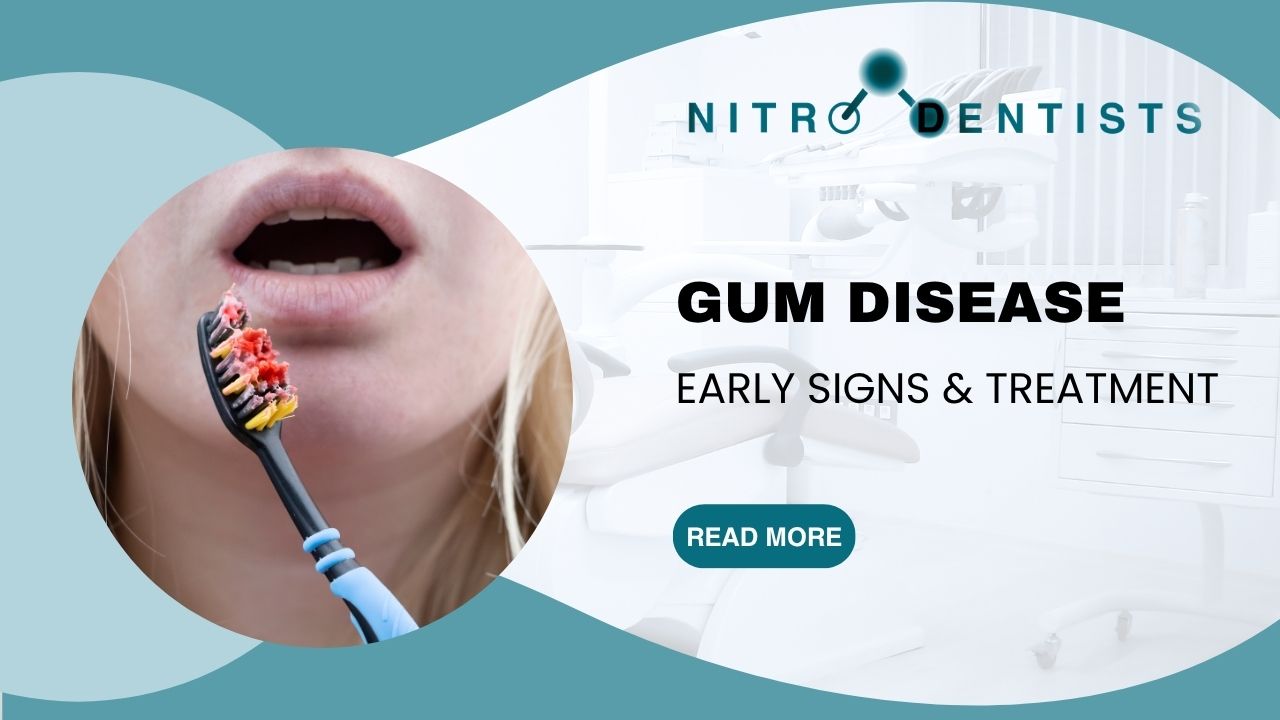 Gum Disease Early Signs