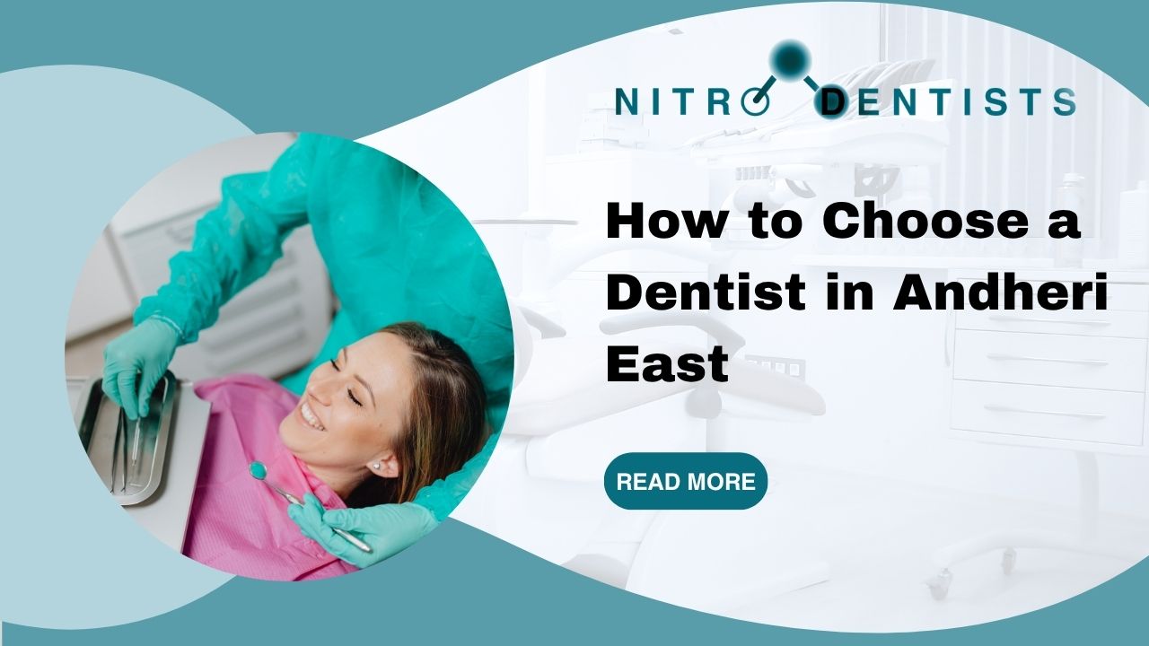 How to Choose a Dentist in Andheri East