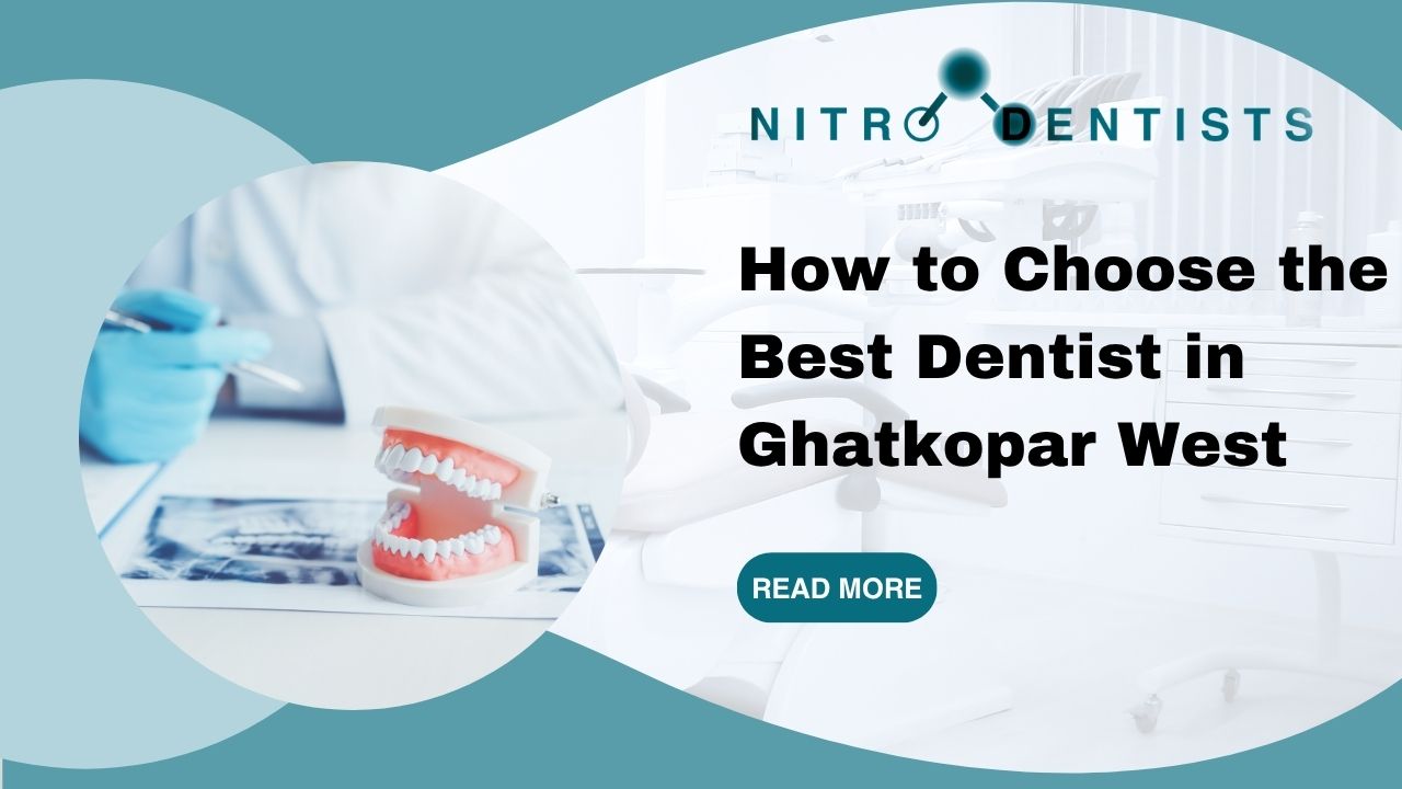 How to Choose the Best Dentist in Ghatkopar West