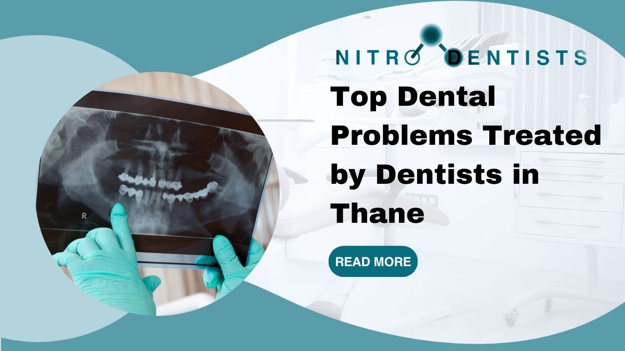 Top Dental Problems Treated by Dentists in Thane | Nitro Dentists